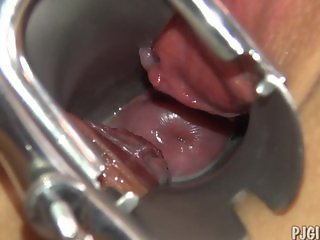 Violeta's orgasms with a speculum in her vagina